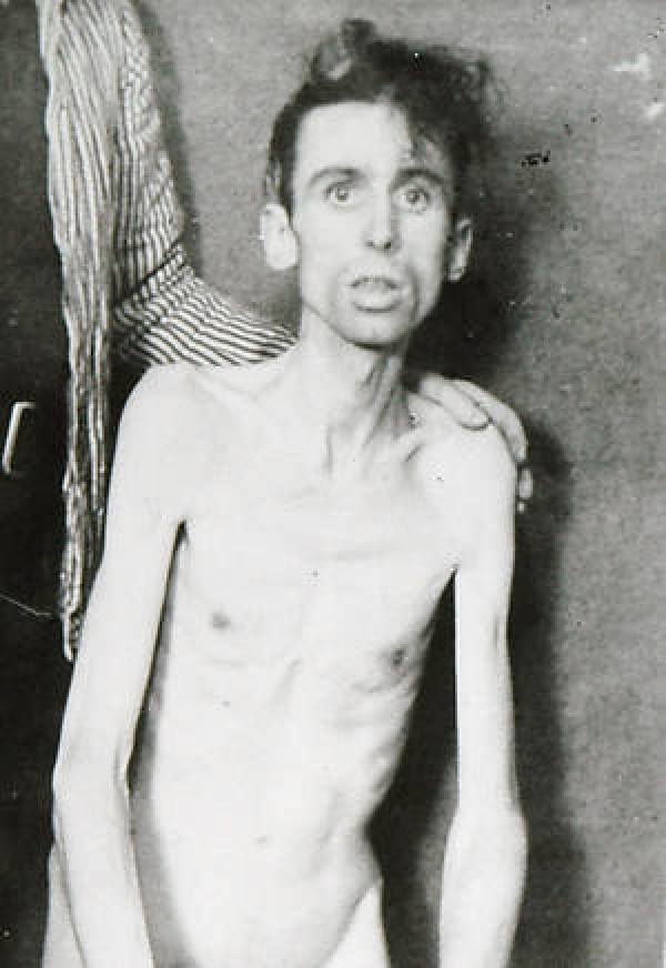 Death by starvation and cold — historical image
